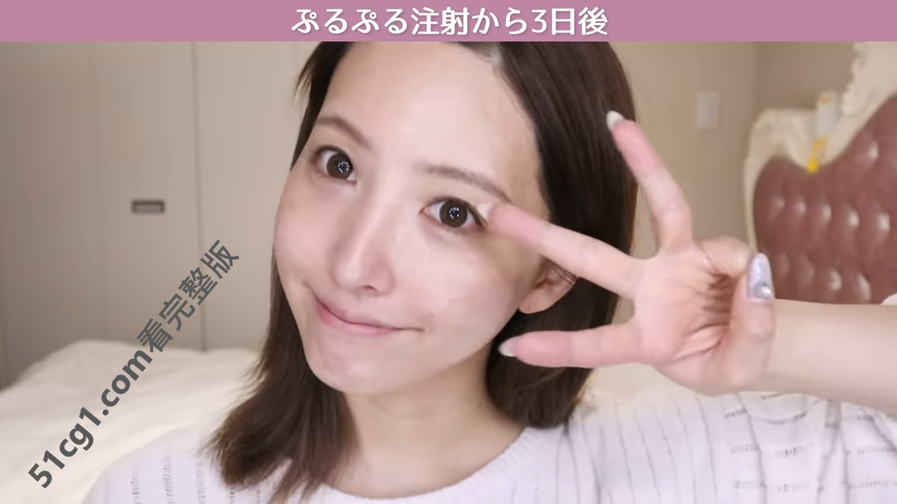 《三上悠亞》首次公開微整過程15.png