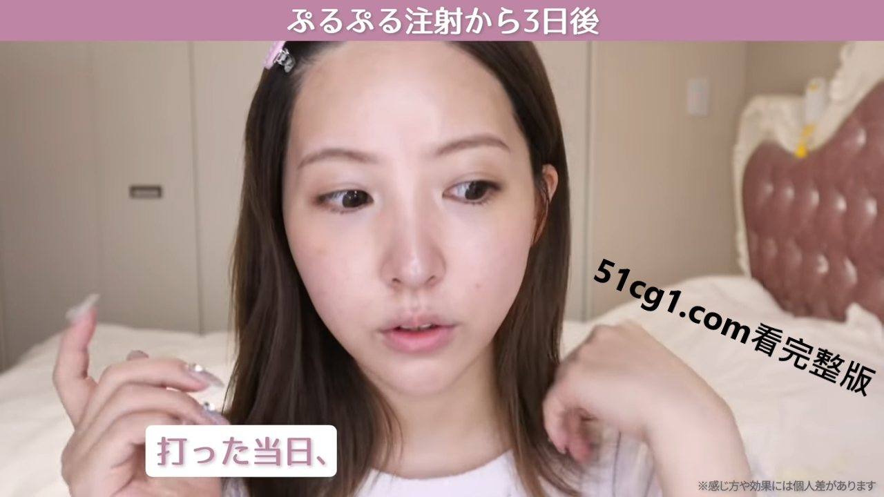 《三上悠亞》首次公開微整過程17.png
