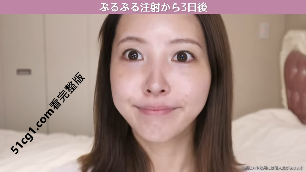 《三上悠亞》首次公開微整過程18.png