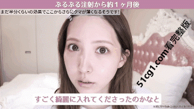 《三上悠亞》首次公開微整過程19.gif