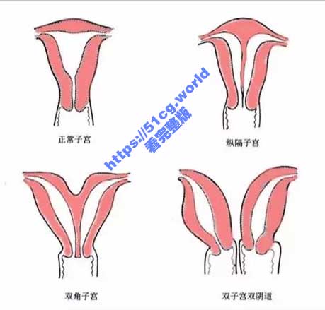 猎奇科普！一女子竟查出双阴道 还有两套生殖系统！一起来看看怎么事