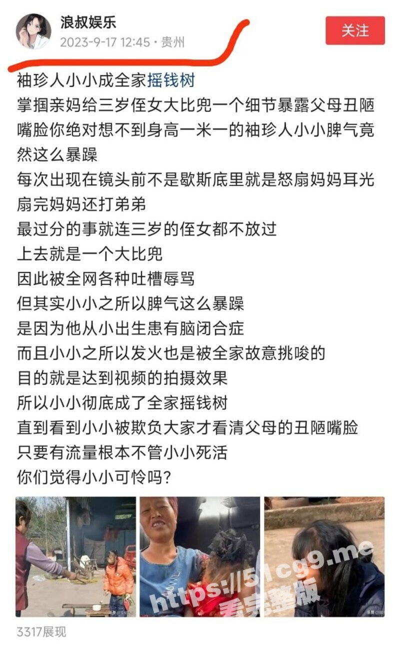 网红 袖珍女孩 脾气暴躁大反转 经遭亲妈残忍虐待挨毒打 全家人当她做摇钱树 早前曝光无人理