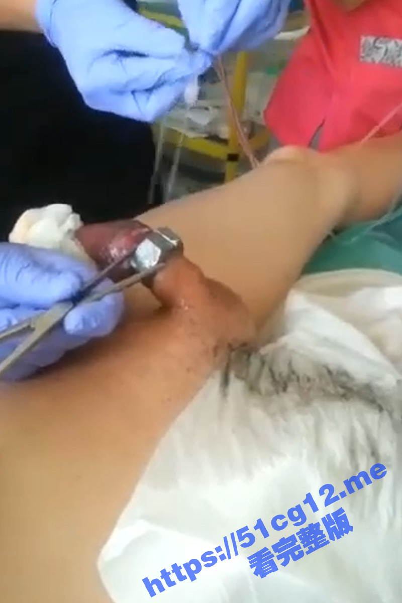 搞笑猎奇！把螺母套到鸡巴上取不下来 只能用电锯把螺丝据下来！