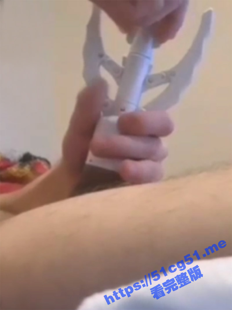 自己动手割包皮 外国人胆真大啊 这工具怎么看着像开瓶器啊 这么自己在家割真的安全么