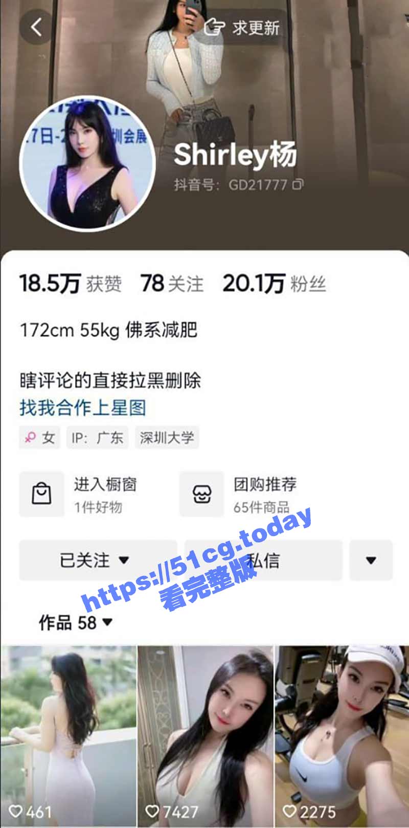 抖音擦边网红 shirley杨 外网私拍流出 露奶扭胯搔首弄姿 前后反差判若两人！