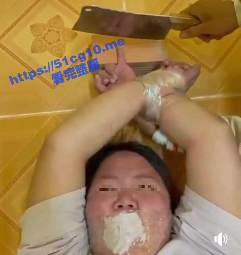 中国女孩王某 被人诱骗到柬埔寨后 遭绑架并被切掉一根手指！剁手指现场视频曝光！