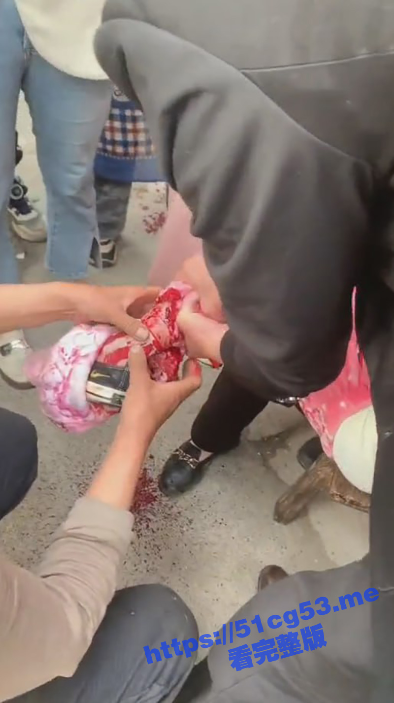 湖南衡阳再现恶犬伤人事件！小女孩被大黑狗死死咬住 狗主人怎么抽打狗就是不松口！