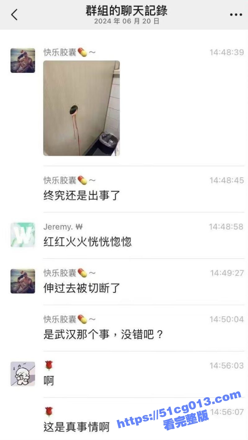 疼疼疼！看着都疼！鸟洞的故事 男同们的恶趣味 这下我看谁还敢乱伸！