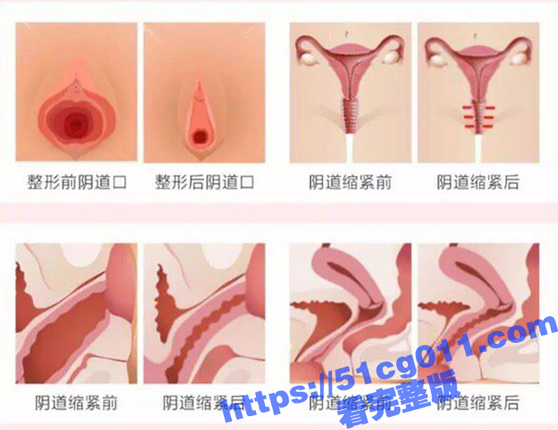 做紧致女人 让性福加倍！广州缩紧针火了 你的她为什么这么紧的原因来了！