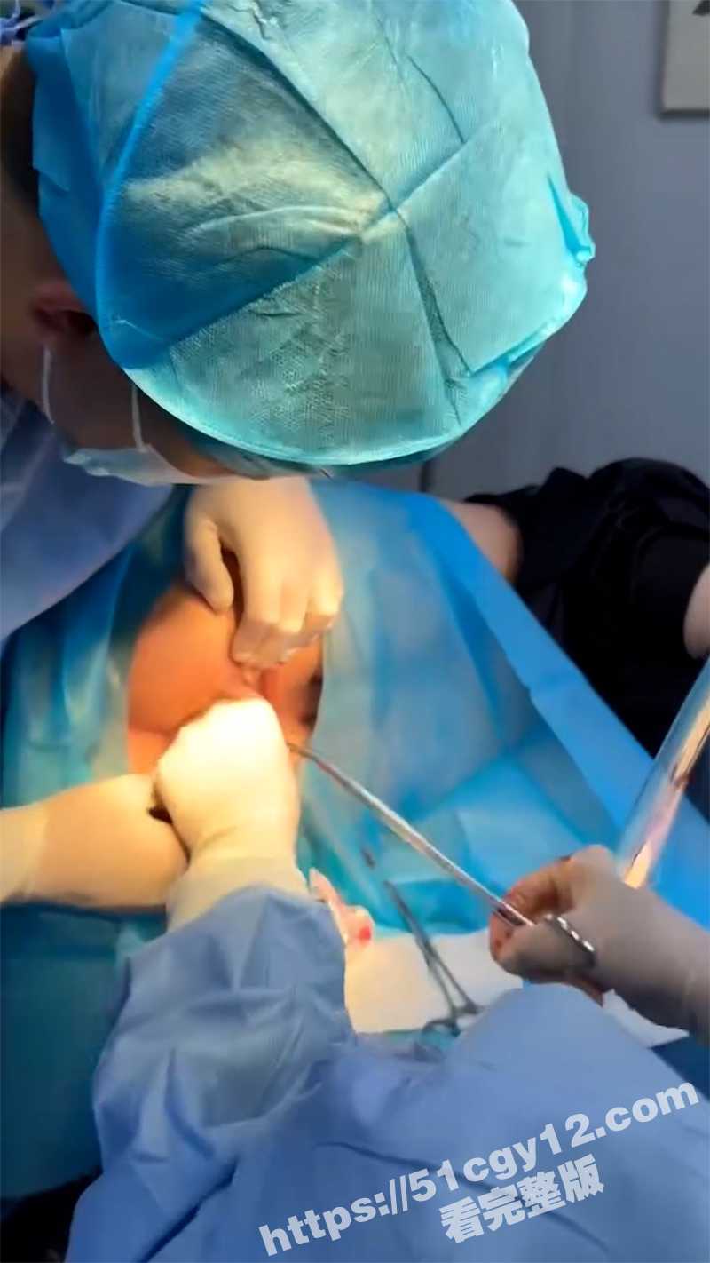 全网公狗第一人 男子深夜寻求刺激将超大号橡胶棒塞入肛门 结果玩的太嗨取不出来啦！