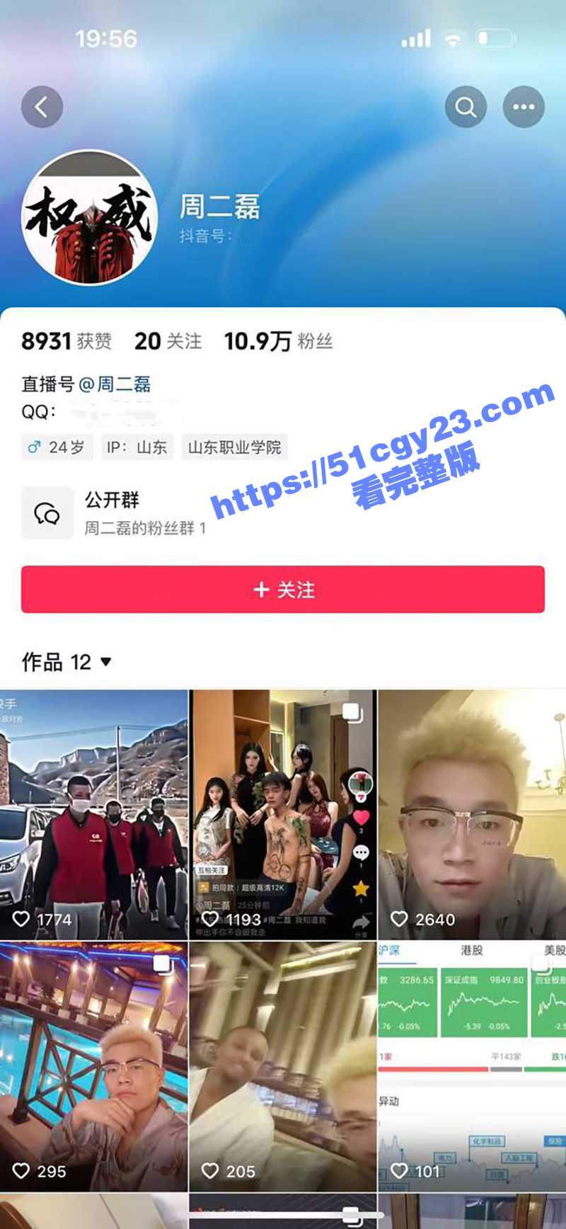 抖音网红 周二磊 事件大瓜 在最红最有流量的时候 被老妈送进精神病院 早期刀砍牛子各种行为艺术大赏！