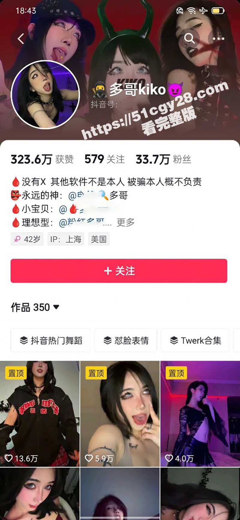 抖音33万网红 多哥kiko 阿黑颜定制私拍 丰满身材性感撩人 高潮脸淫舞骚到爆炸！