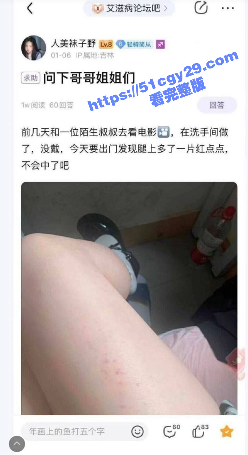 百度贴吧艾滋病论坛吧一美少女不幸感染上艾滋病 拷贝 2