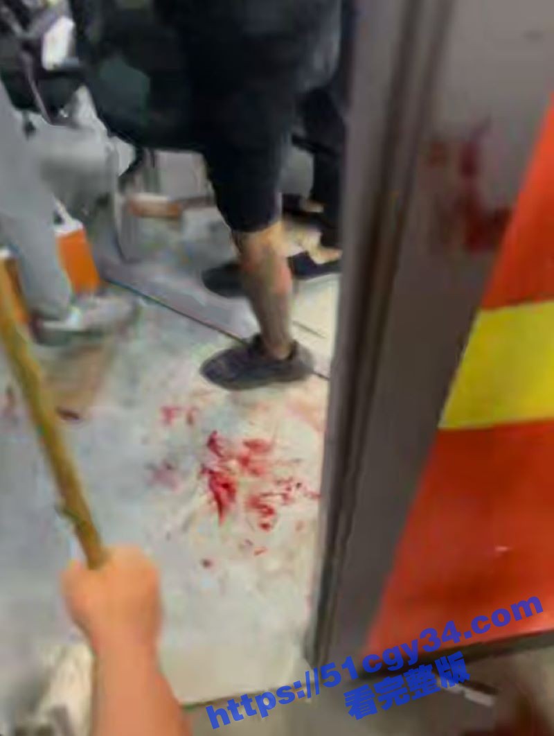 精神小伙台球厅持刀砍人 6