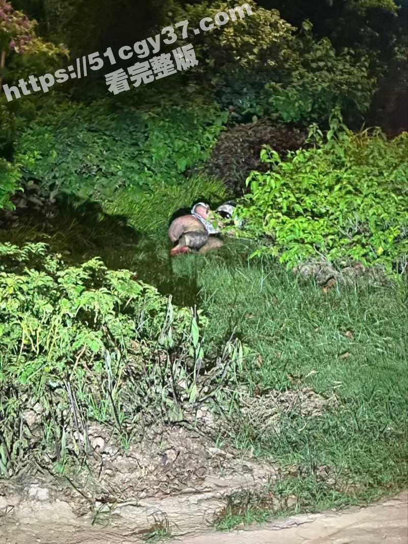 女子骑电动车起火被烧伤衣不蔽体03