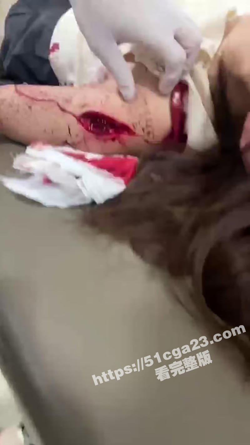 男子持菜刀砍伤妻视频（3）