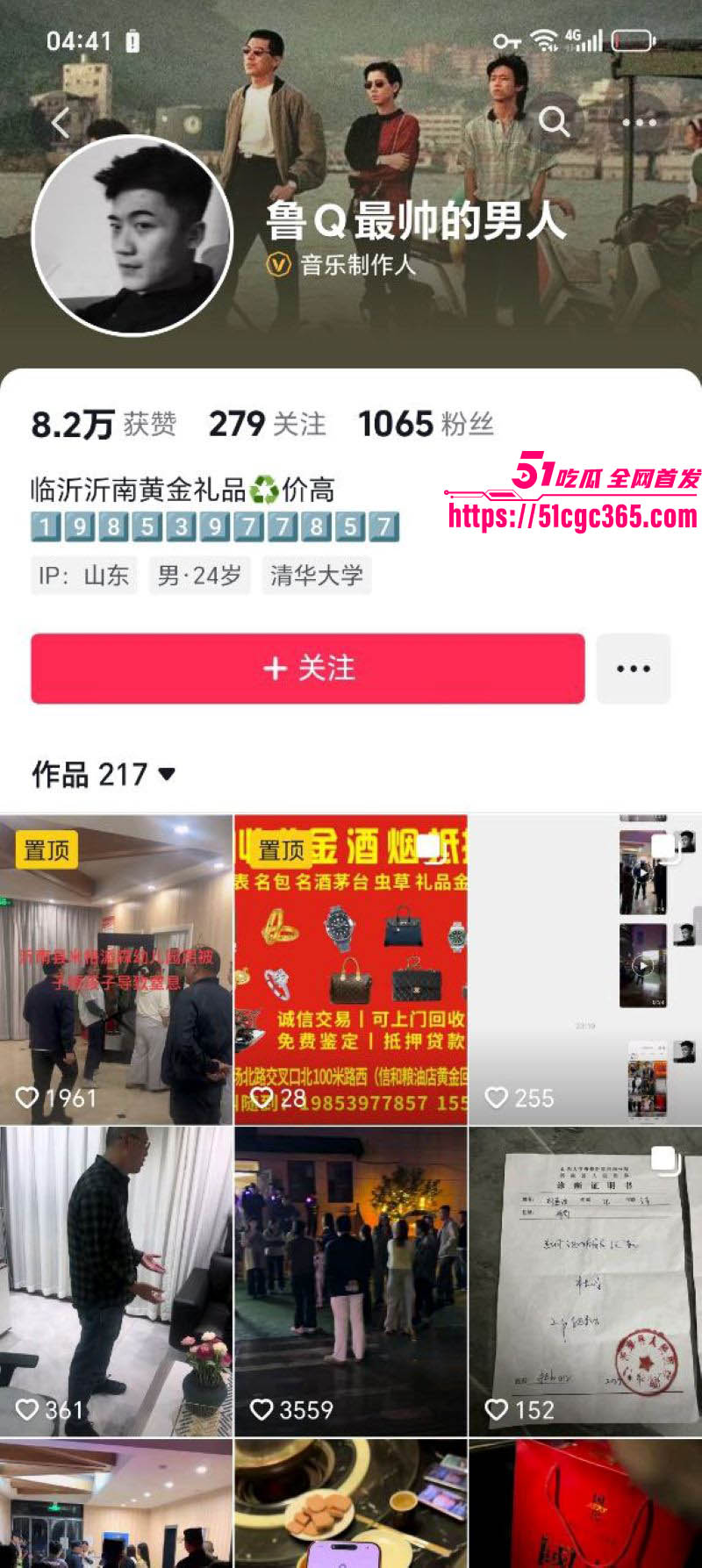 沂南米格派森幼儿园虐童事件 保安暴力阻录像 掐肚子关黑屋捂脸 孩子浑身淤青哭喊 简直禽兽不如！