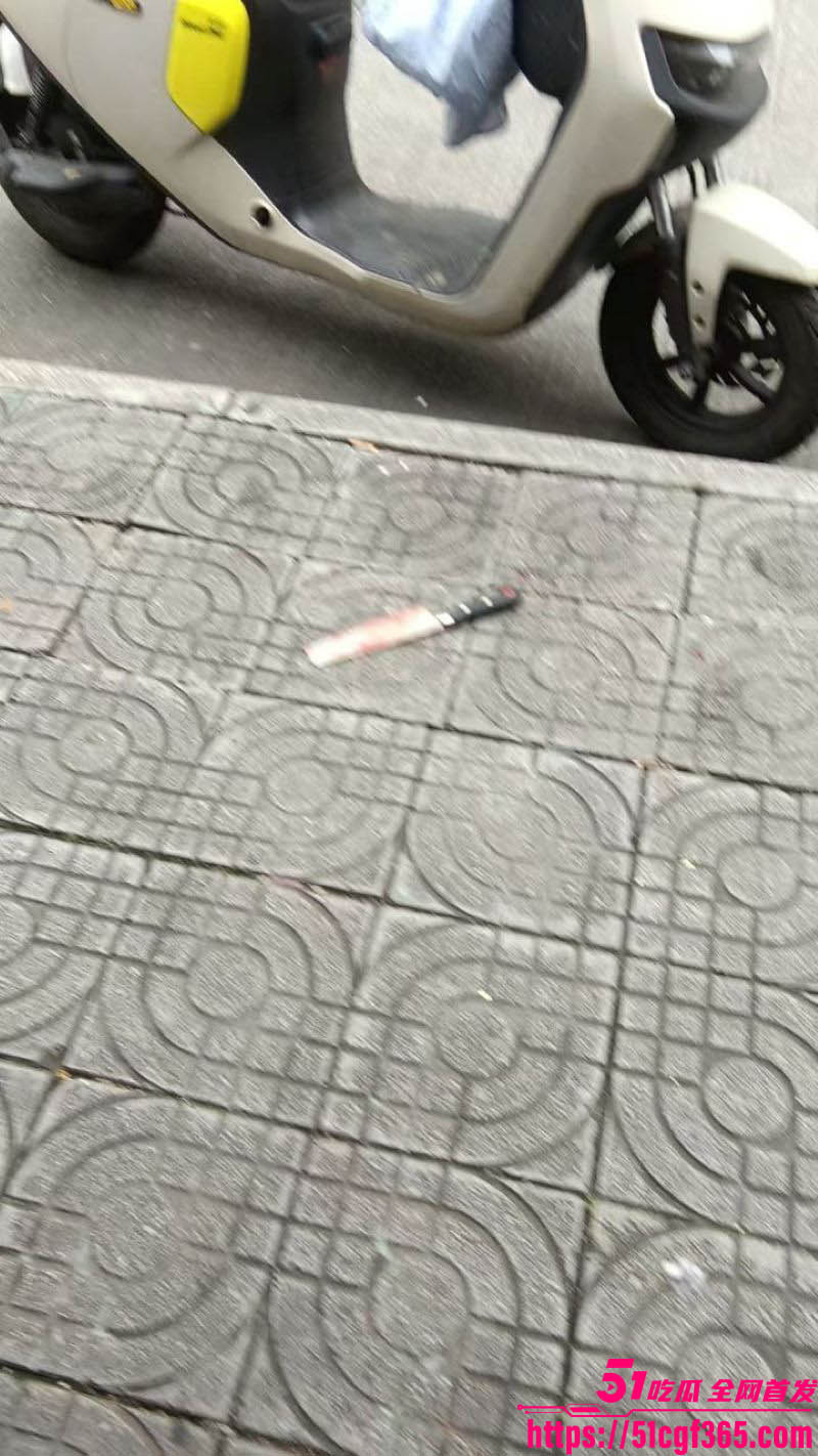 广西柳州柳北大润发精神小伙斗殴持刀砍头皮事件 5