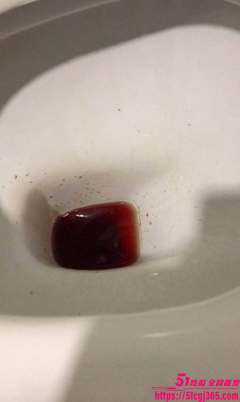 国庆节撸管翻车 狠人瓜友把自己撸进ICU 聊天记录全爆疯狂自述 瓜友们要节制啊！