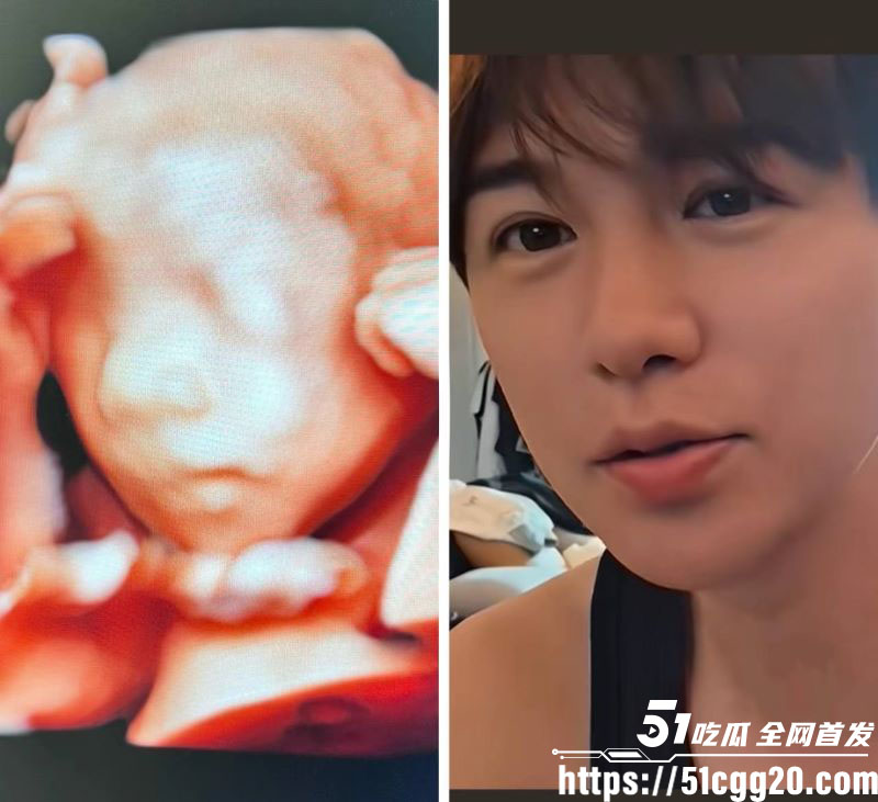 江南第一深情童锦程私生子曝光 13