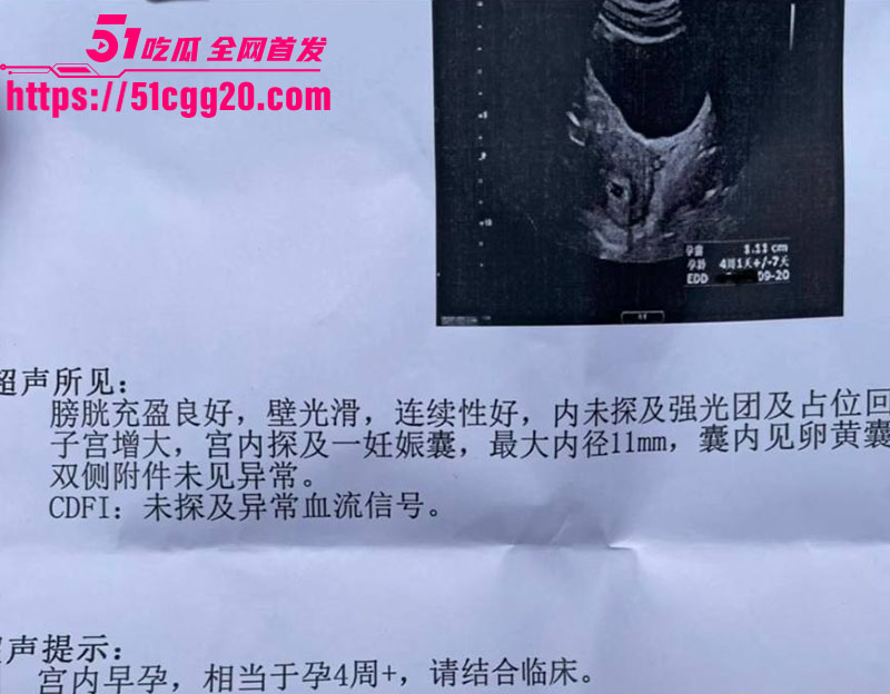 知名演员李沁被爆私生活混乱036
