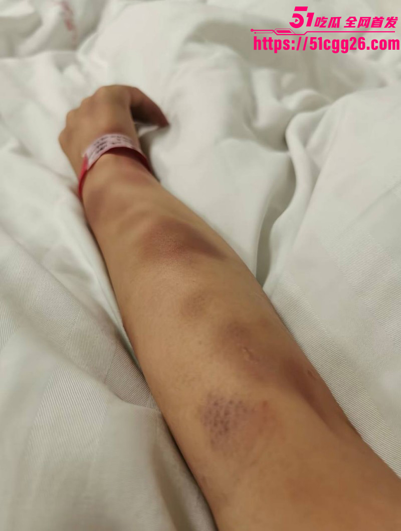女网红娜姐重生曝光丈夫高飞家暴出轨024