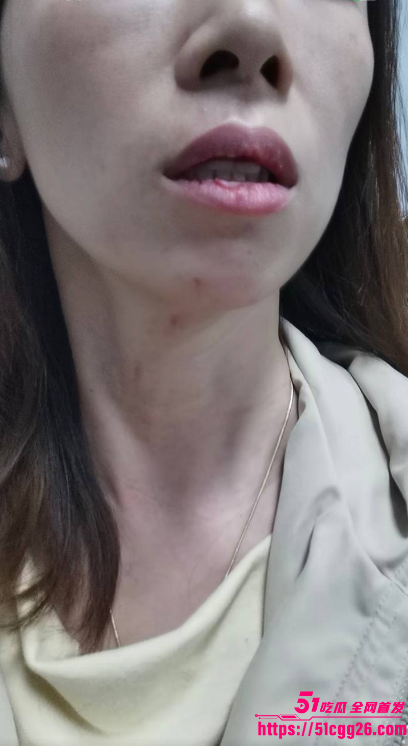 女网红娜姐重生曝光丈夫高飞家暴出轨025