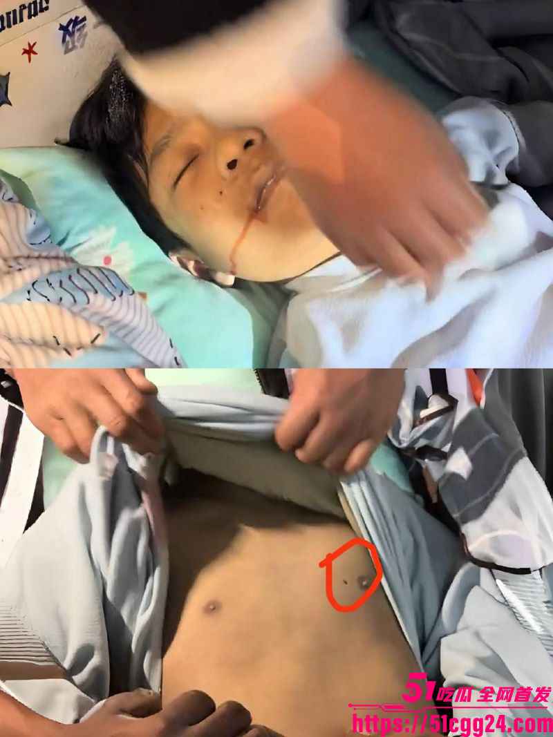 河南新蔡清华园校园惨案！学生遭钢管群殴致死 心脏现诡异血洞 校方偷运遗体被拦 换器官传闻再次流出！