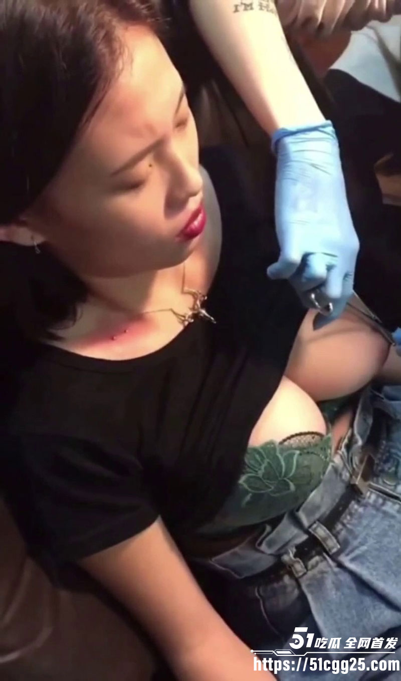 乳钉穿刺全程视频8