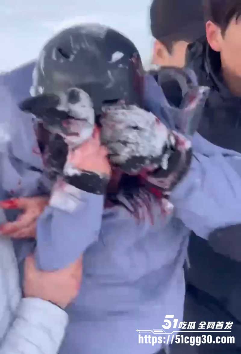 可可托海雪豹咬人视频曝光 3 拷贝