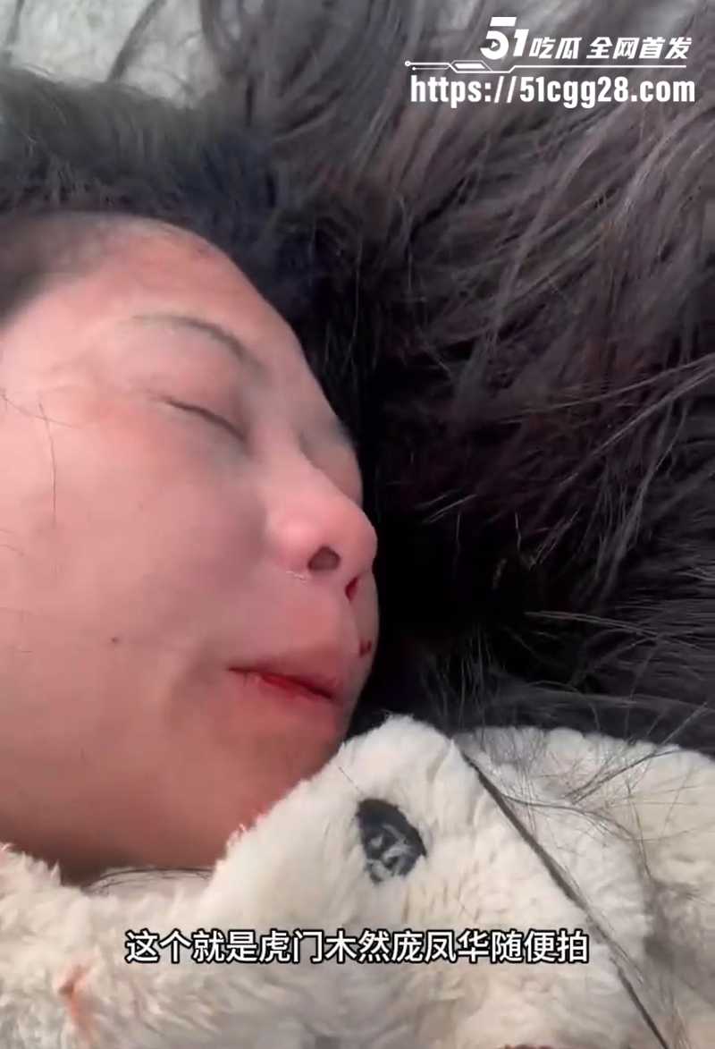 虎门木然庞凤华出轨被对象暴打曝光私密视频9拷贝