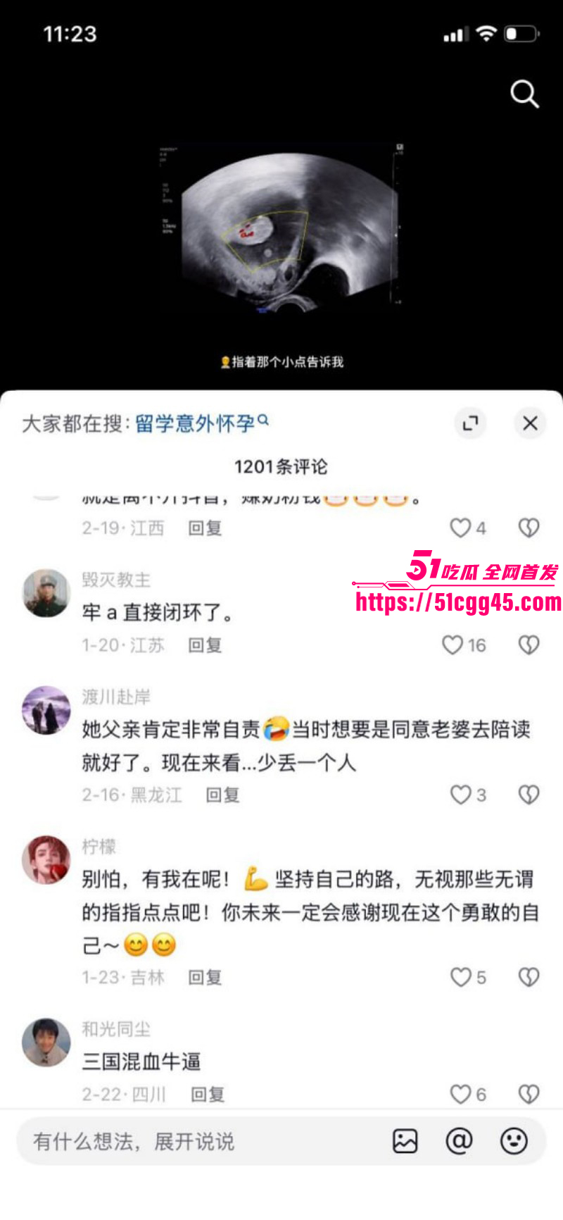德国留学生攀小宝怀孕回国找接盘侠017