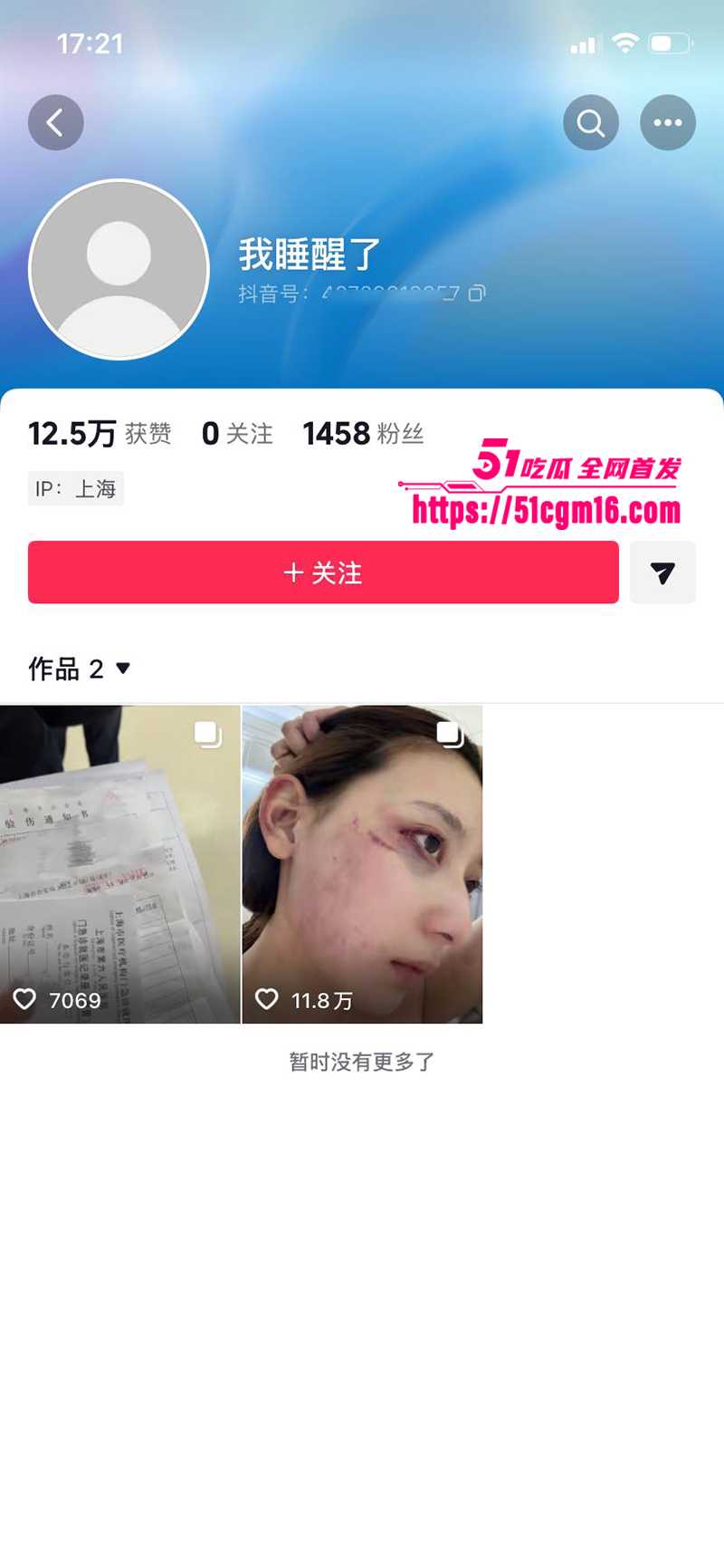 千万大V张百乔 家暴视频被扒 从甜宠裸婚到半年零同框 拳打脚踢挥菜刀 小雪火速回应却藏玄机！