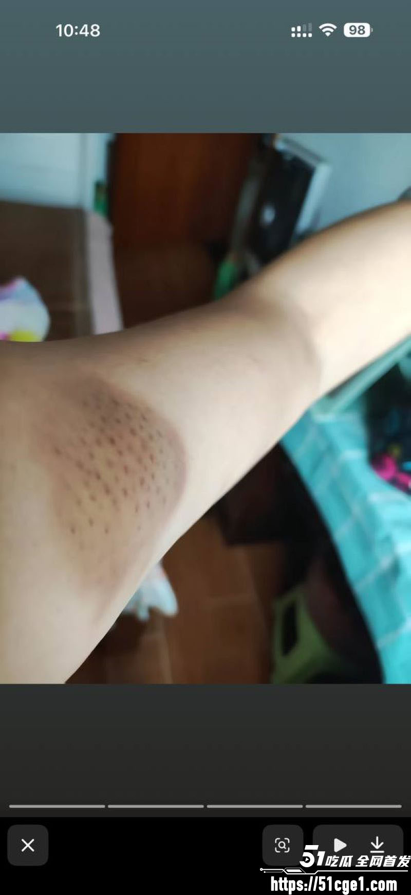 重庆53岁王作红遭丈夫家暴事件 10