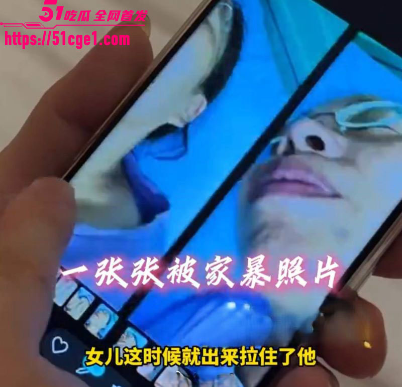 重庆53岁王作红遭丈夫家暴事件 15