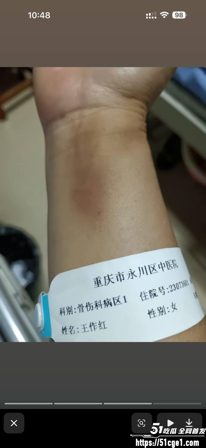 重庆53岁王作红遭丈夫家暴事件 9