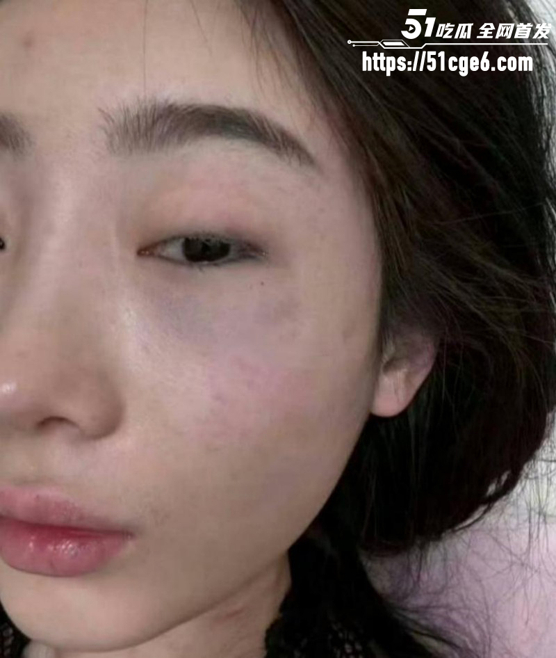 快手网红摇童被前任缇娜发文控诉07