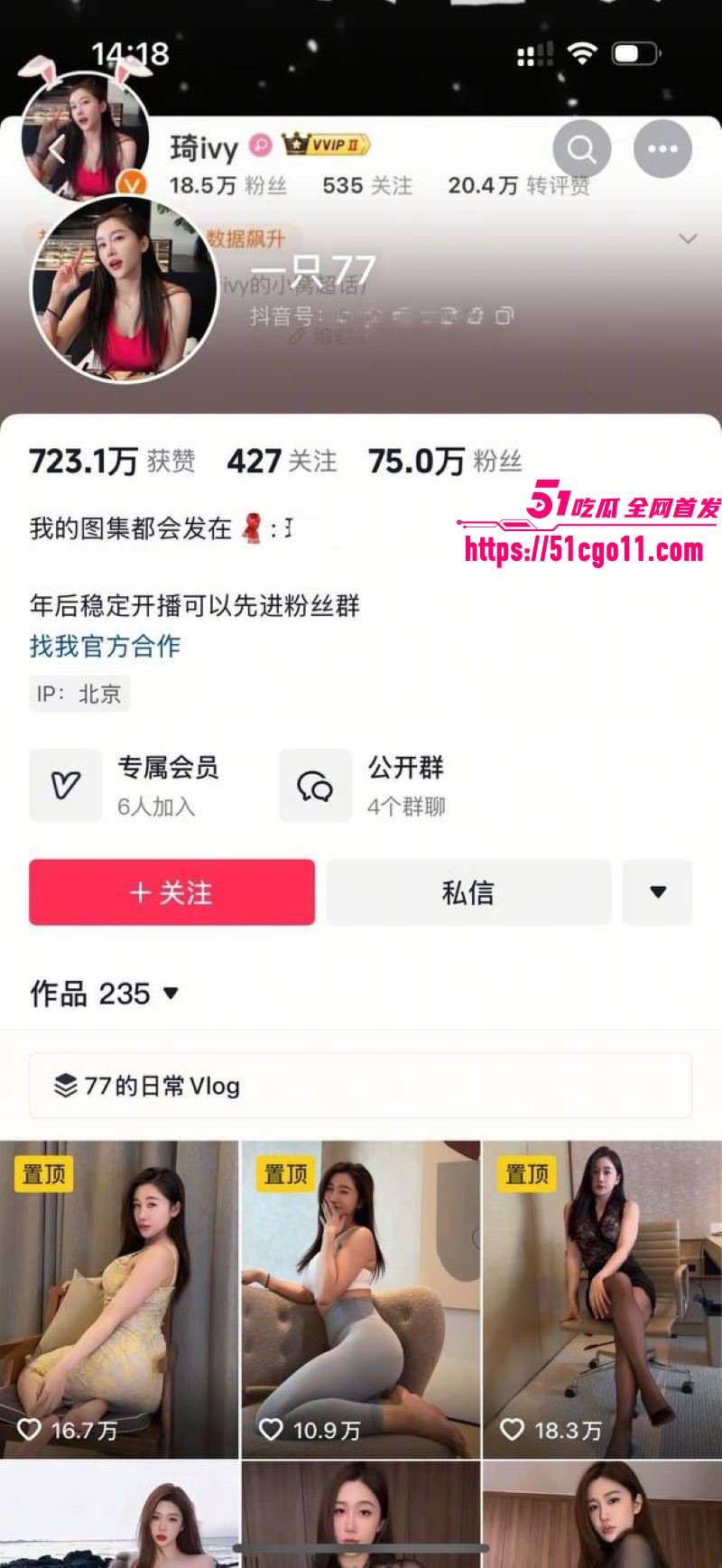 抖音75万粉少妇 一只77 粉丝群福利 情趣黑丝丁字内裤私拍 春光乍现诱惑拉满！