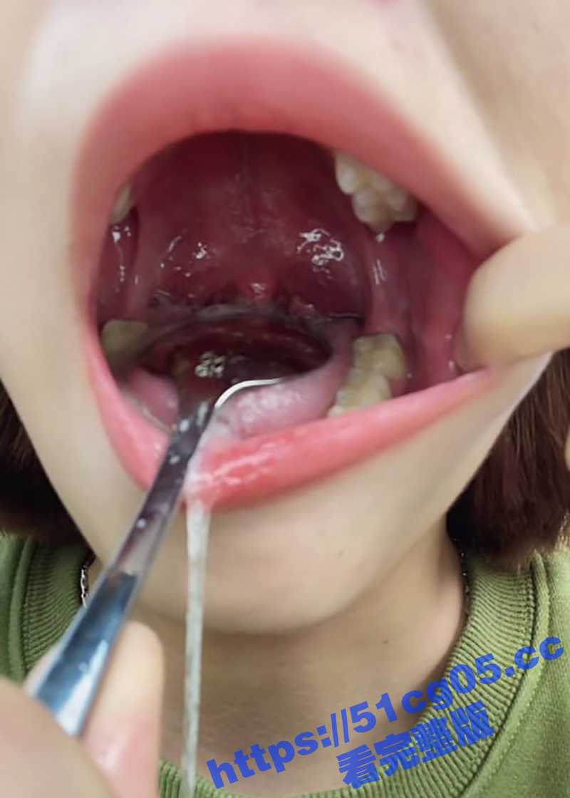 超极品美女口腔检查系相关图片