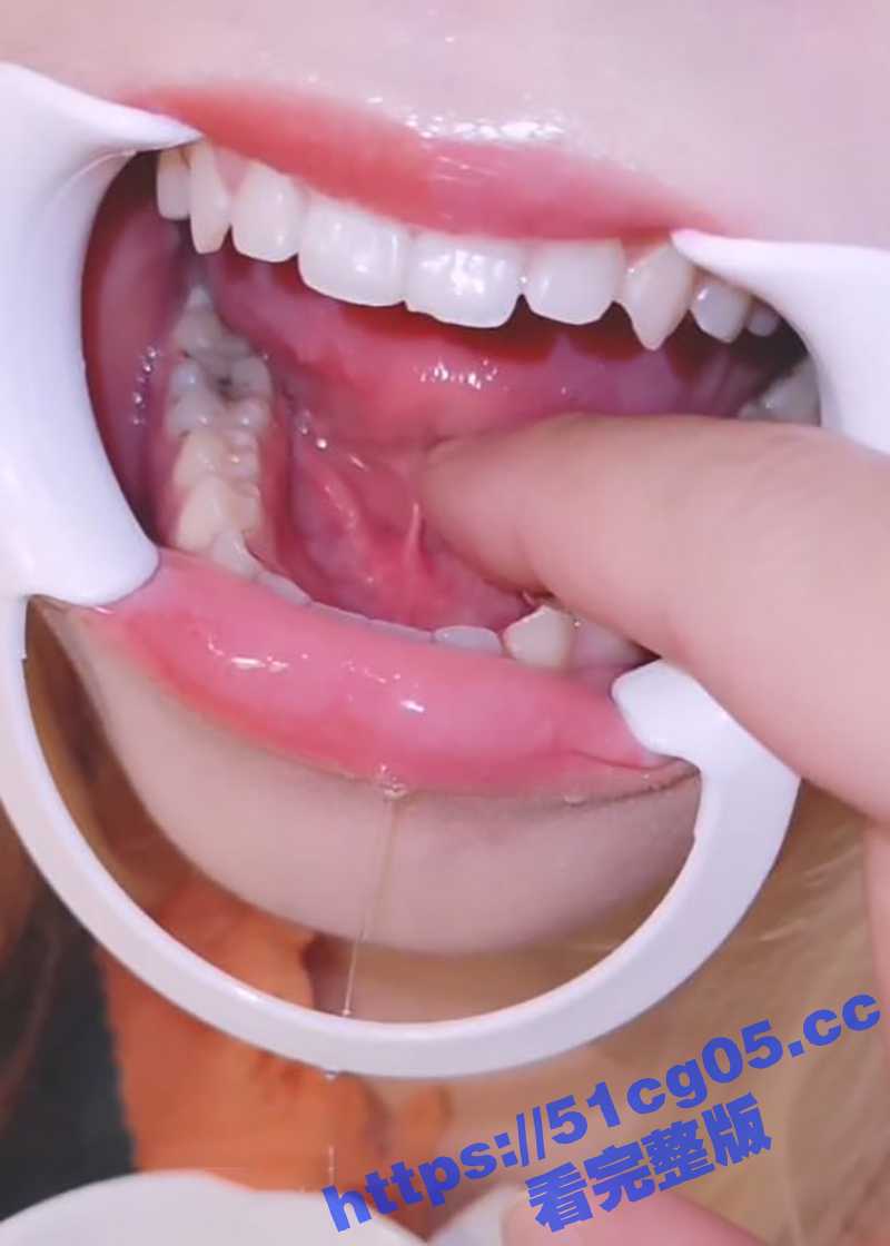 超极品美女口腔检查系相关图片