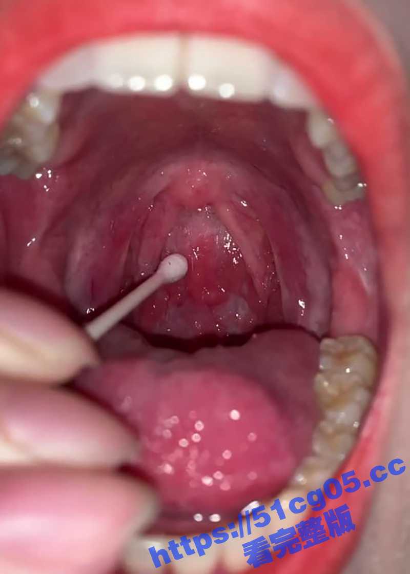 超极品美女口腔检查系相关图片