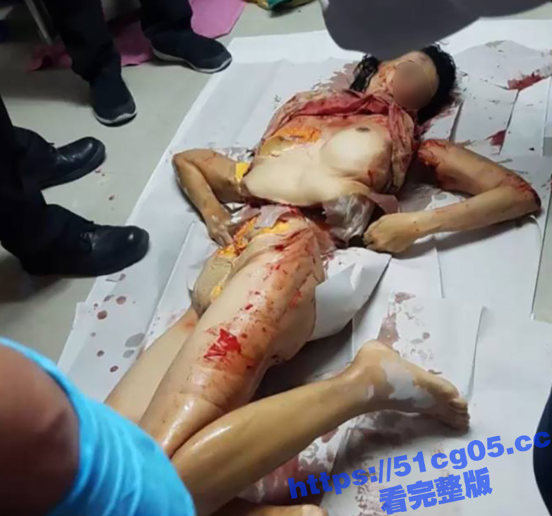 血腥慎入！！！天津小相关图片