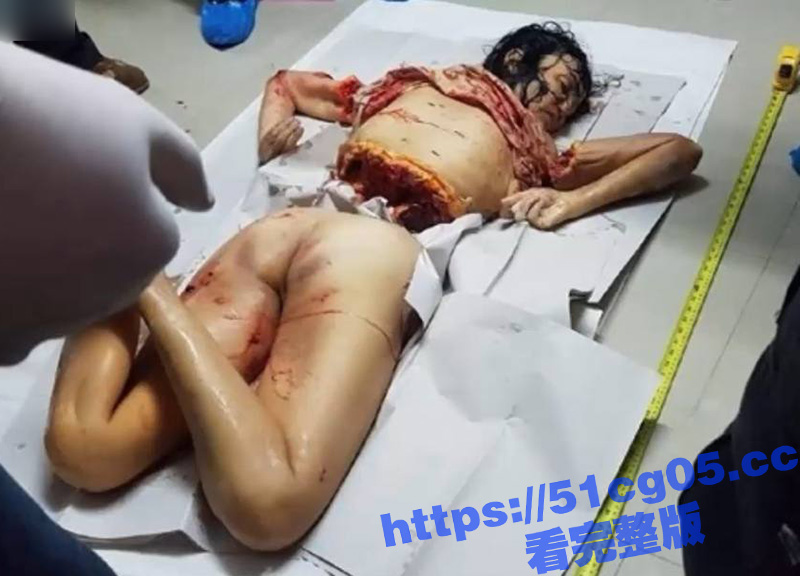 血腥慎入！！！天津小相关图片