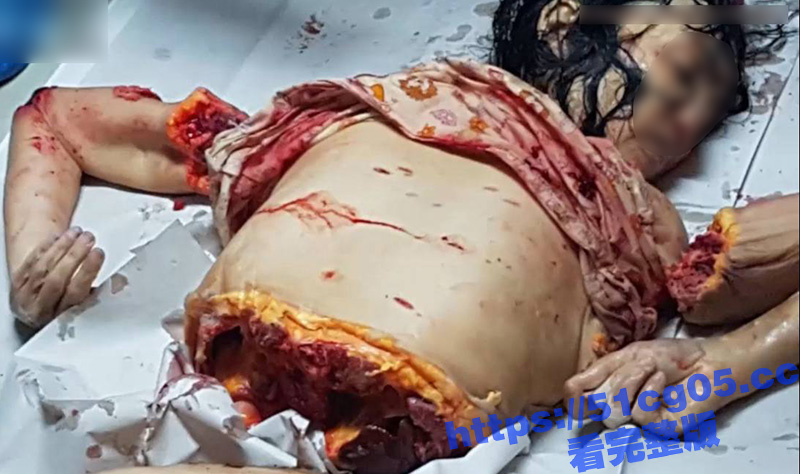 血腥慎入！！！天津小相关图片