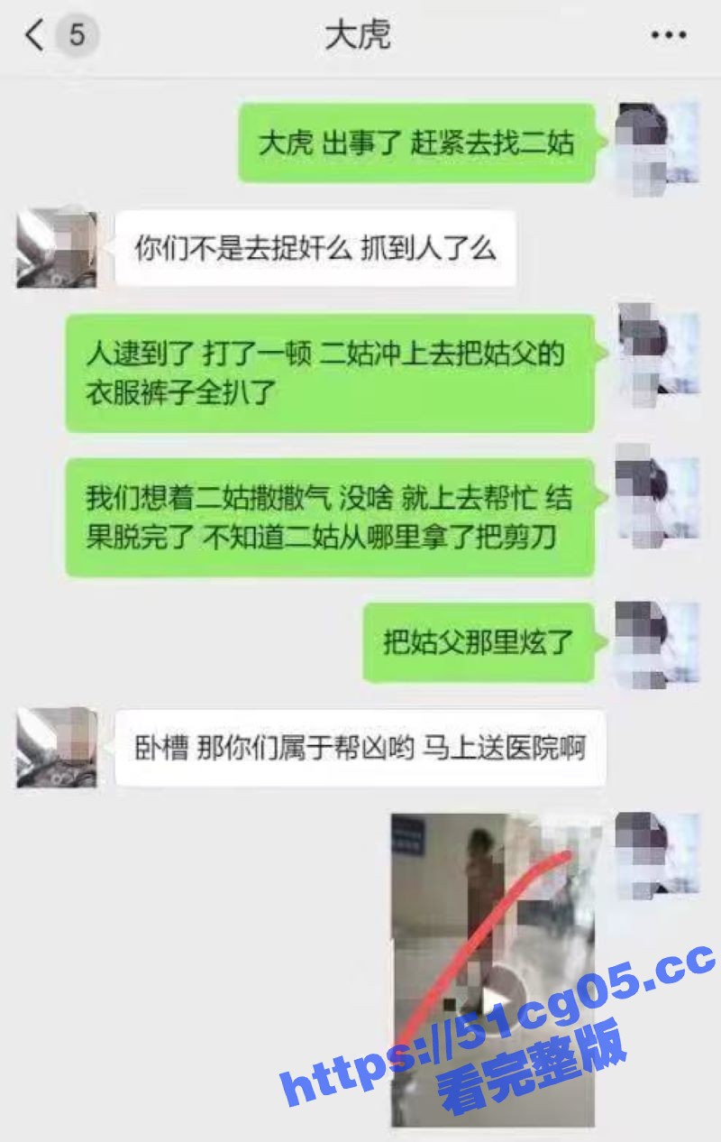 恐怖！姑父偷情跟着二姑一起去抓奸 没想到二姑拿了把剪刀把姑父鸡鸡给剪了