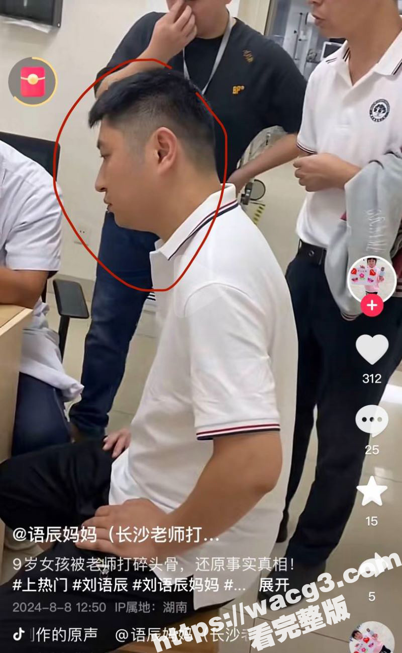 长沙市博才西湖小学教师 宋雨明 用三角尺打碎九岁女学生头骨 祖国花朵遭悲剧！