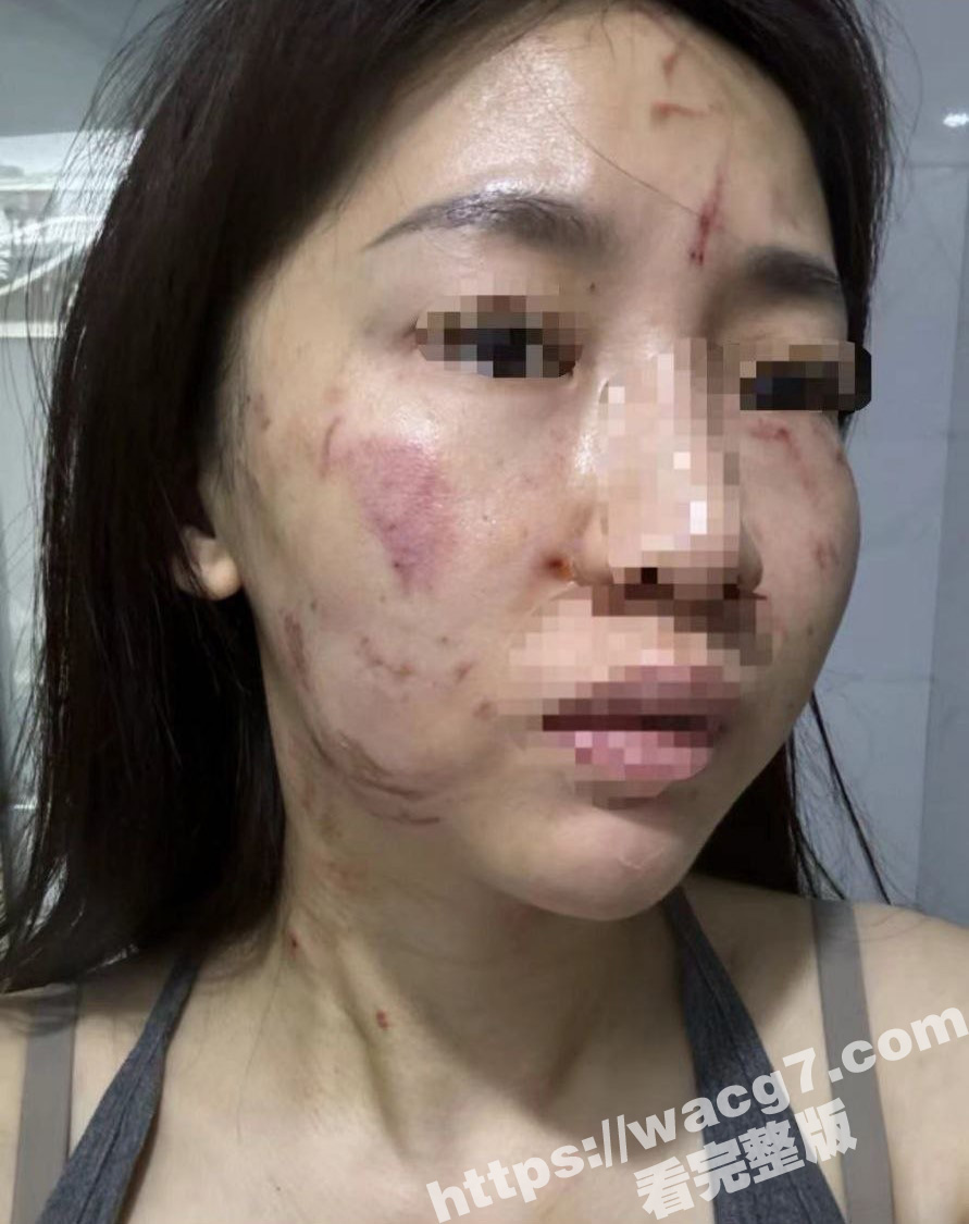 曝光揭东区庵后村家暴相关图片