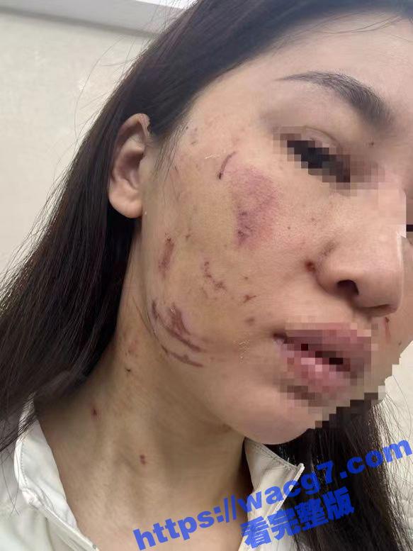 曝光揭东区庵后村家暴相关图片