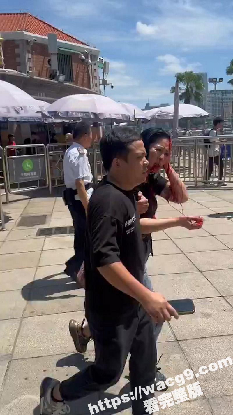 突发事件！厦门一对夫妻从思明区法院鼓浪屿分院办理离婚后 丈夫突然从包里拿出折叠刀捅向妻子头部