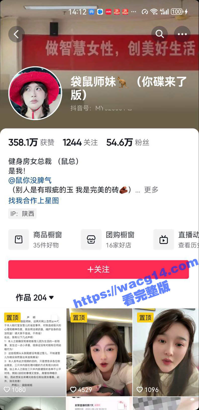 三只羊袋鼠师妹直播爆相关图片